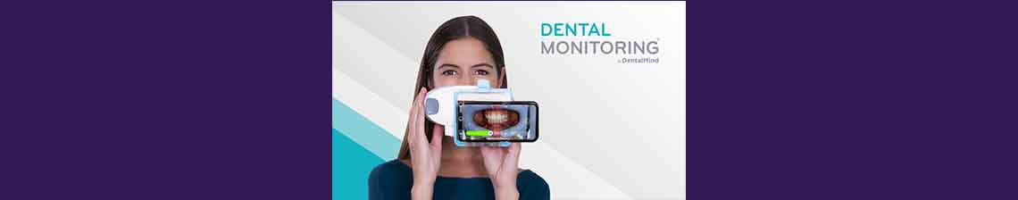 dental-monitoring-banner
